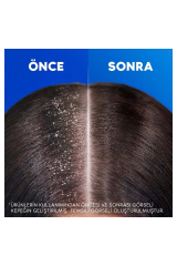 Head And Shoulders Şampuan Limon Ferahlığı 1in1 330 ml